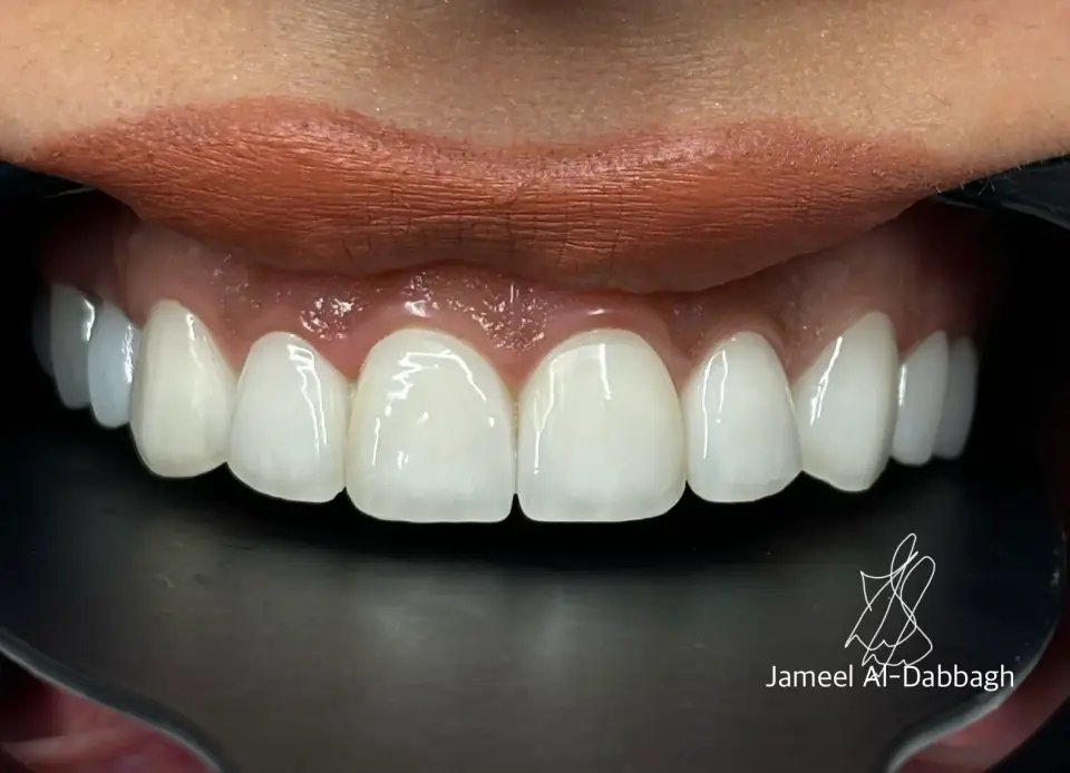 Alpha dental clinic · Erbil (Hewlêr)