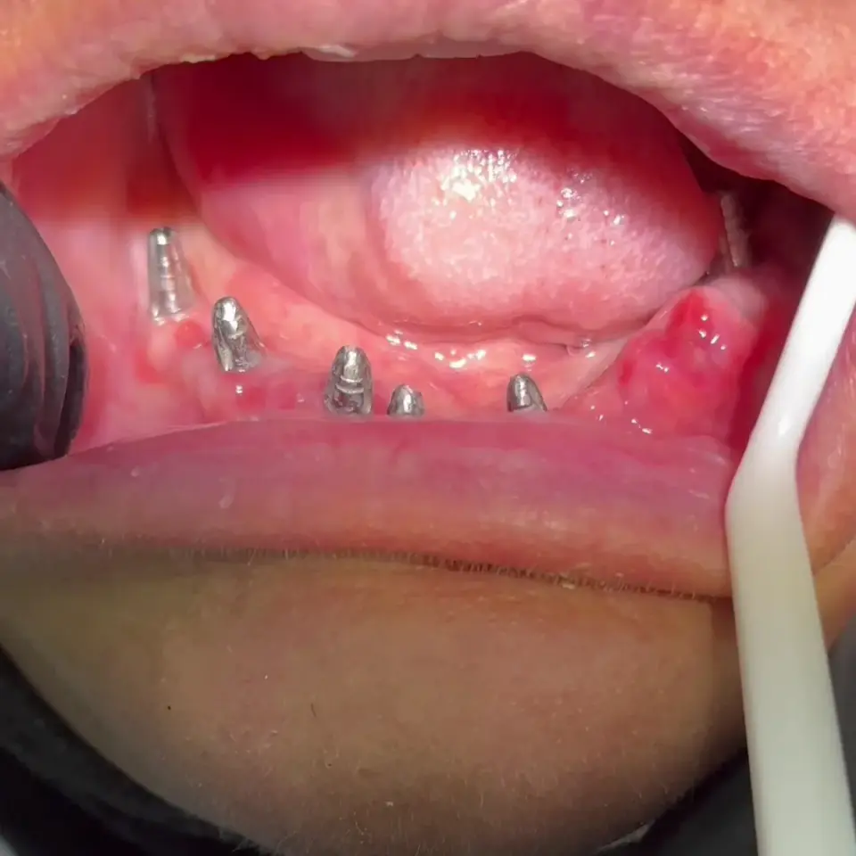 Dr.Azad Dental Clinic عيادة الأسنان دكتور ازاد جميل · Duhok (Dihok)