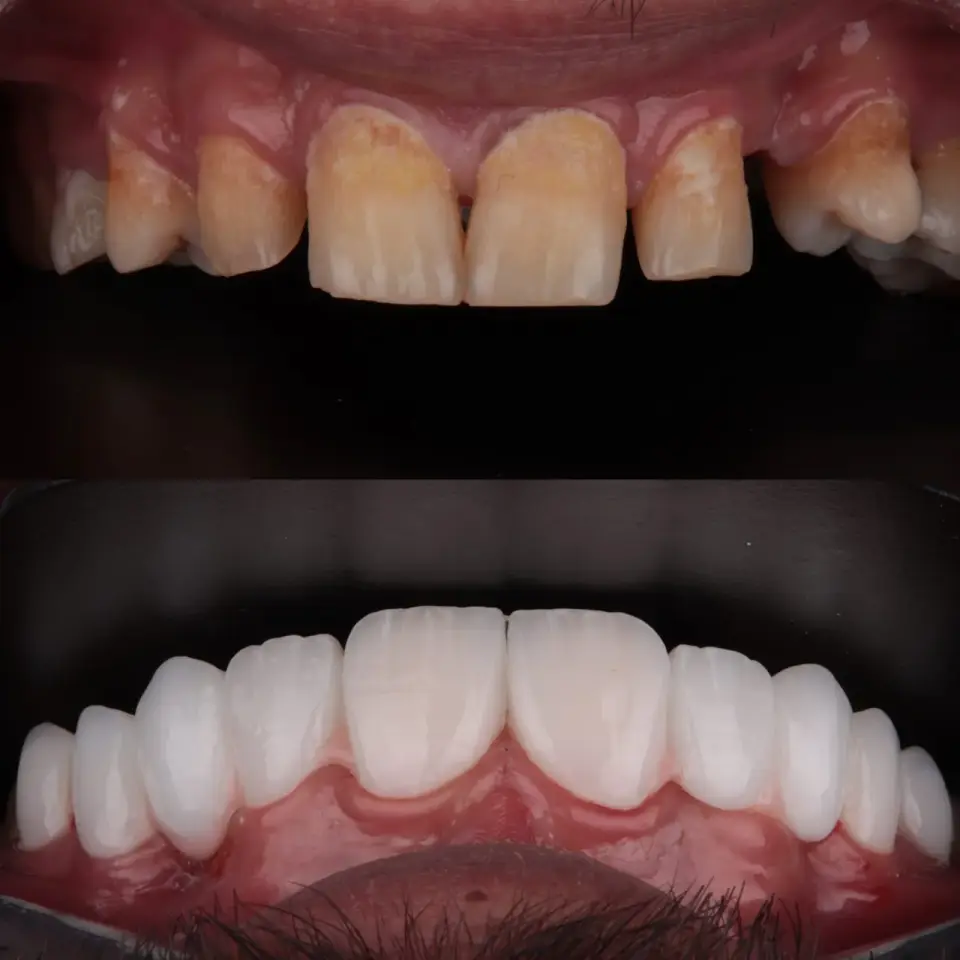 Dr Younis Shekhani dental clinic · Erbil (Hewlêr)