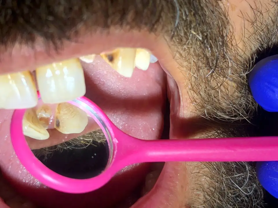 عيادة الدكتور محمد نعمان لطب وتجميل الاسنان · Kirkuk